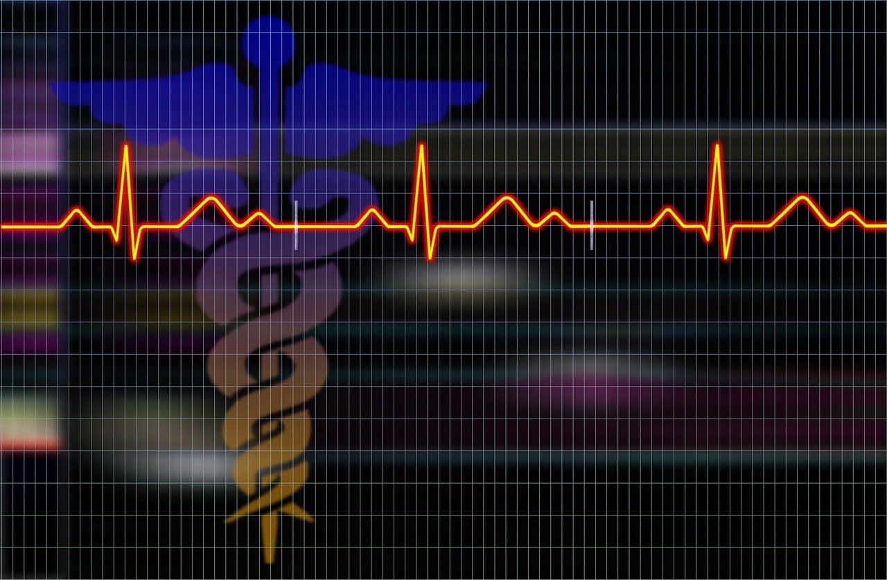 découvrez l'importance du taux de rétention dans la fidélisation des clients et l'amélioration des performances de votre entreprise. apprenez à mesurez, analyser et optimiser ce kpi essentiel pour garantir une croissance durable.